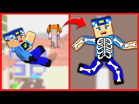 KEREM KOMSER ÇATIDAN DÜŞTÜ TÜM KEMİKLERİ KIRILDI! 😱 – Minecraft